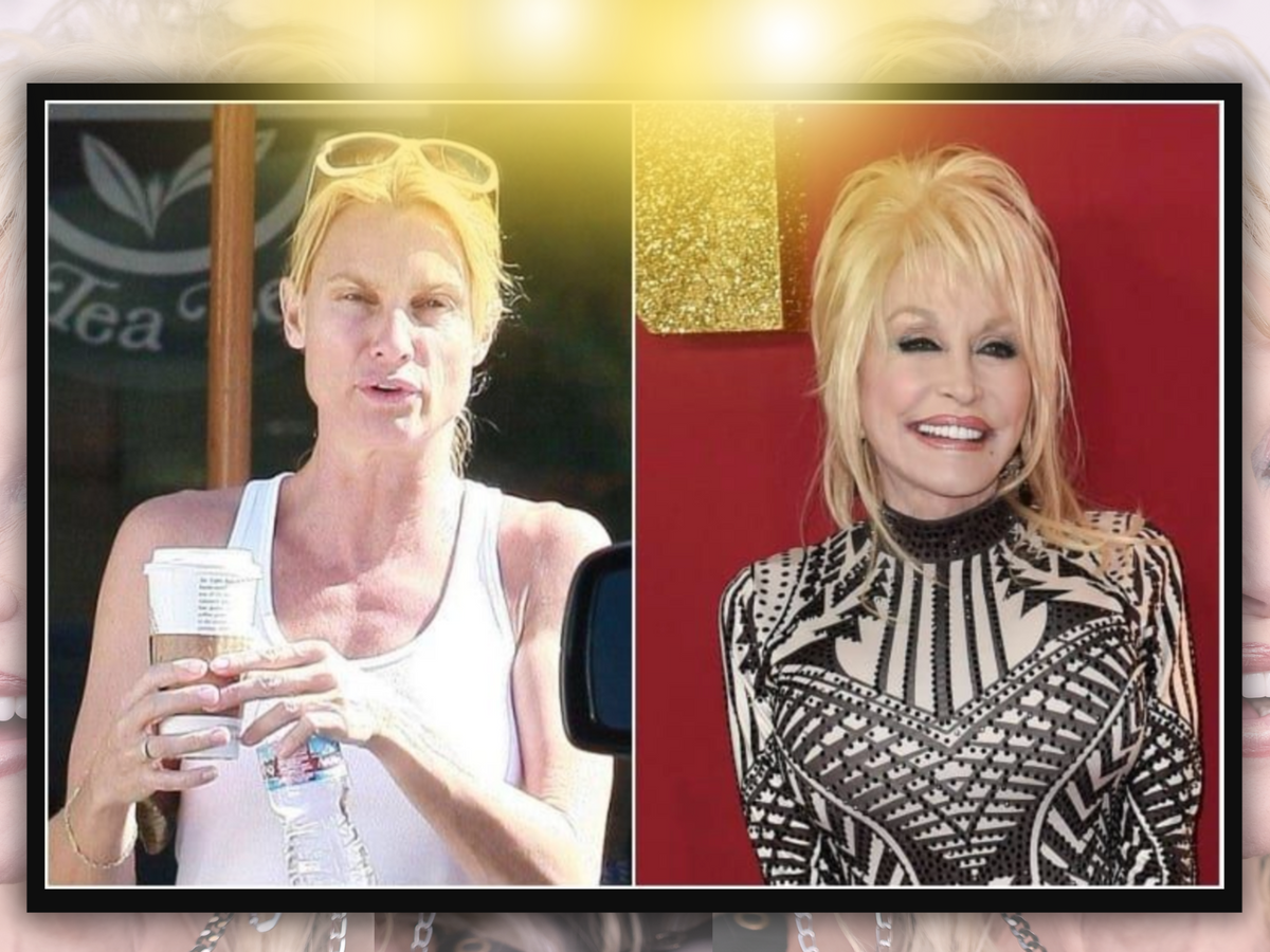 See Pictures of Dolly Parton Without Makeup: A Rare Glimpse at Her Bare Face (Discover Her Natural Beauty Secrets)